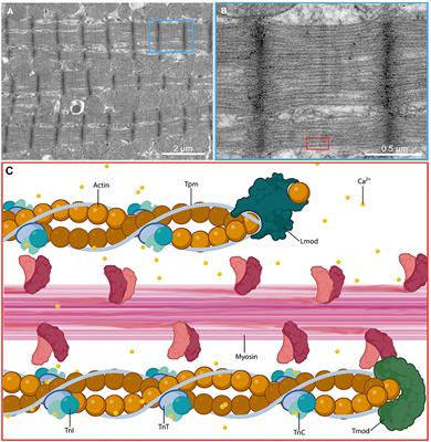 Thin filament cardiomyopathies: A review of genetics, disease mechanisms, and emerging therapeutics